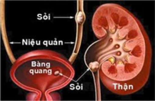 Nguy biến do thừa canxi