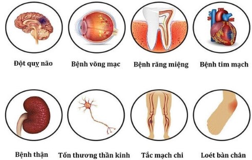 Một số cập nhật từ hội nghị khoa học thường niên của Liên đoàn Đái tháo đường thế giới năm 2025