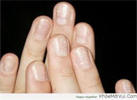 Dấu hiệu cho biết cơ thể đang thiếu kẽm