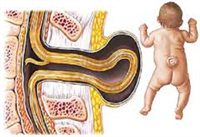 Vai trò của acid folic trong dự phòng dị tật thai nhi